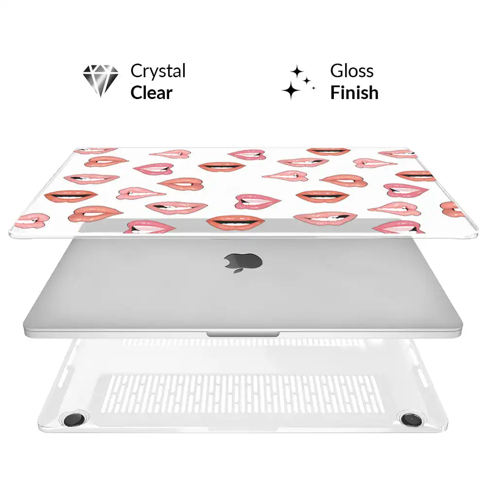 Nude Lips MacBook Case